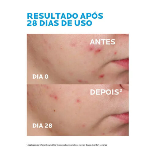 La Roche-Posay Effaclar Ultra Concentrado - Sérum Antiacne 30ml - Image 7
